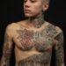 Can You Remove Only Part of a Tattoo?